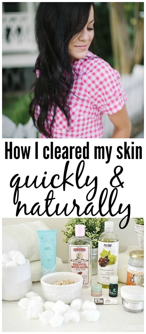 How I healed my skin - Natural skincare routine.